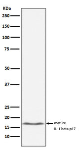 Anti-IL-1 beta Rabbit Monoclonal Antibody Boster Bio