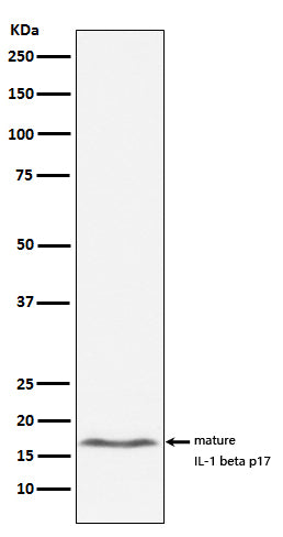 Anti-IL-1 beta Rabbit Monoclonal Antibody Boster Bio
