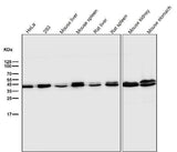 Anti-ERK1/2 MAPK3 Rabbit Monoclonal Antibody Boster Bio