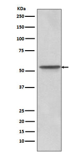 Anti-Src Rabbit Monoclonal Antibody Boster Bio