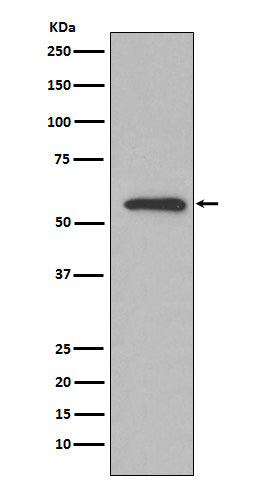 Anti-Glucose 6 phosphate isomerase Rabbit Monoclonal Antibody Boster Bio