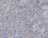 Anti-PD-L1 (CD274) Rabbit Monoclonal Antibody Boster Bio