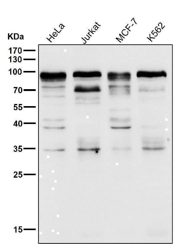 Anti-SP1 Rabbit Monoclonal Antibody Boster Bio