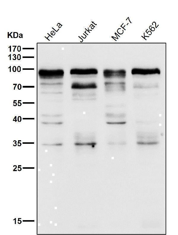 Anti-SP1 Rabbit Monoclonal Antibody Boster Bio