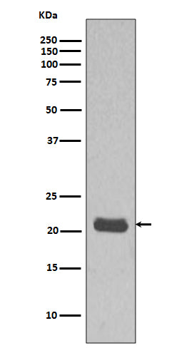 Anti-GTPase HRAS Rabbit Monoclonal Antibody Boster Bio