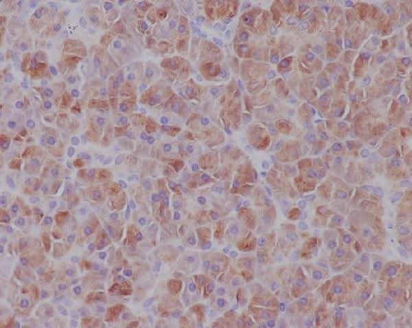 Anti-IRF7 Rabbit Monoclonal Antibody Boster Bio