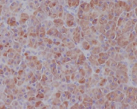 Anti-IRF7 Rabbit Monoclonal Antibody Boster Bio