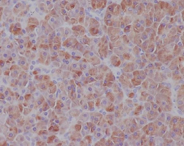 Anti-IRF7 Rabbit Monoclonal Antibody Boster Bio