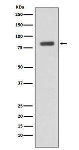 Anti-IKK beta IKBKB Rabbit Monoclonal Antibody Boster Bio