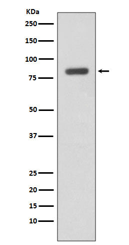 Anti-IKK beta IKBKB Rabbit Monoclonal Antibody Boster Bio