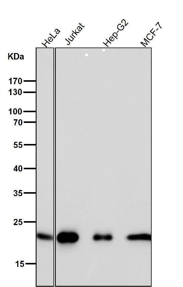 Anti-CDC42 Rabbit Monoclonal Antibody Boster Bio