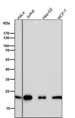 Anti-CDC42 Rabbit Monoclonal Antibody Boster Bio