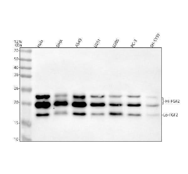 Anti-FGF2/Fgf Basic Rabbit Monoclonal Antibody Boster Bio