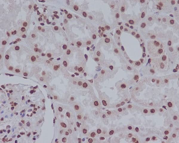 Anti-Cleaved PARP PARP1 Rabbit Monoclonal Antibody Boster Bio