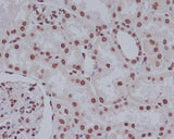 Anti-Cleaved PARP PARP1 Rabbit Monoclonal Antibody Boster Bio