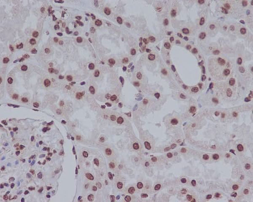 Anti-Cleaved PARP PARP1 Rabbit Monoclonal Antibody Boster Bio