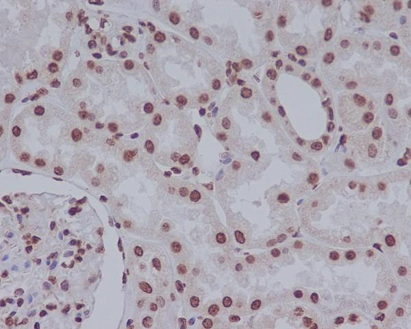 Anti-Cleaved PARP PARP1 Rabbit Monoclonal Antibody Boster Bio