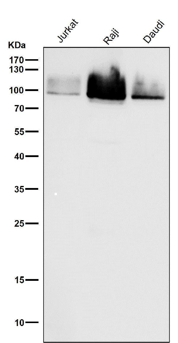 Anti-Cleaved PARP PARP1 Rabbit Monoclonal Antibody Boster Bio