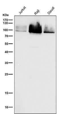Anti-Cleaved PARP PARP1 Rabbit Monoclonal Antibody Boster Bio
