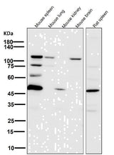 Anti-PARP PARP1 Rabbit Monoclonal Antibody Boster Bio