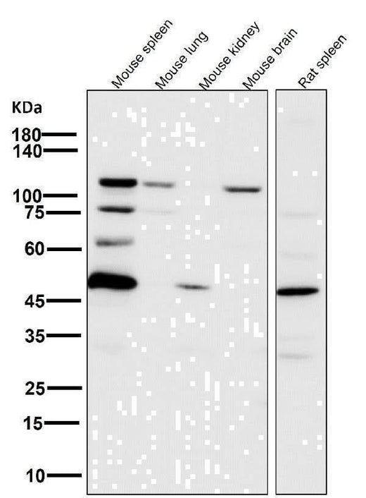 Anti-PARP PARP1 Rabbit Monoclonal Antibody Boster Bio