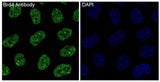 Anti-Brd4 Rabbit Monoclonal Antibody Boster Bio
