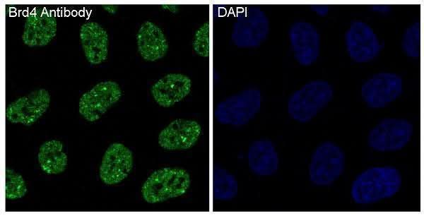 Anti-Brd4 Rabbit Monoclonal Antibody Boster Bio