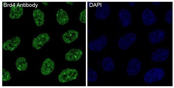 Anti-Brd4 Rabbit Monoclonal Antibody Boster Bio