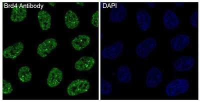 Anti-Brd4 Rabbit Monoclonal Antibody Boster Bio