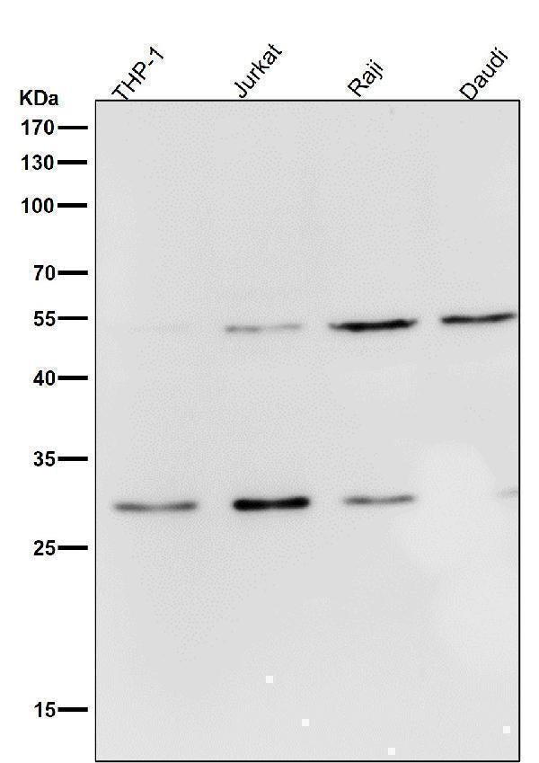 Anti-Parkin PARK2 Rabbit Monoclonal Antibody Boster Bio