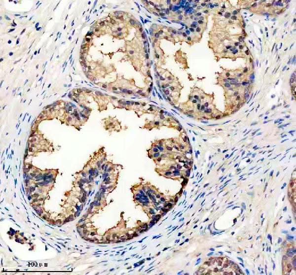 Anti-IDH1 Rabbit Monoclonal Antibody Boster Bio