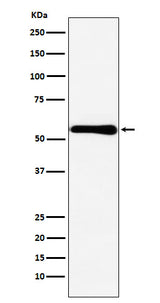 Anti-CBS Rabbit Monoclonal Antibody Boster Bio