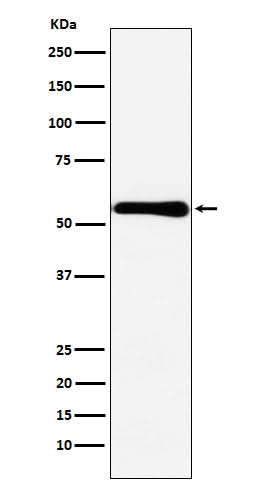 Anti-CBS Rabbit Monoclonal Antibody Boster Bio