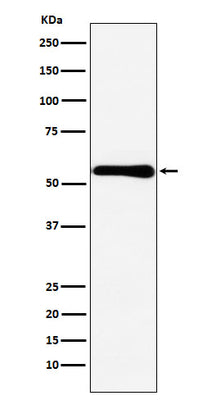 Anti-CBS Rabbit Monoclonal Antibody Boster Bio