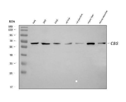 Anti-CBS Antibody Picoband® (monoclonal, 5B5D7 Boster Bio