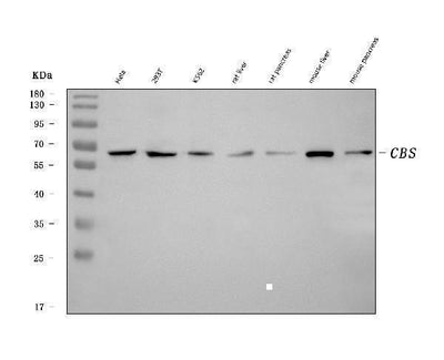 Anti-CBS Antibody Picoband® (monoclonal, 5B5D7 Boster Bio