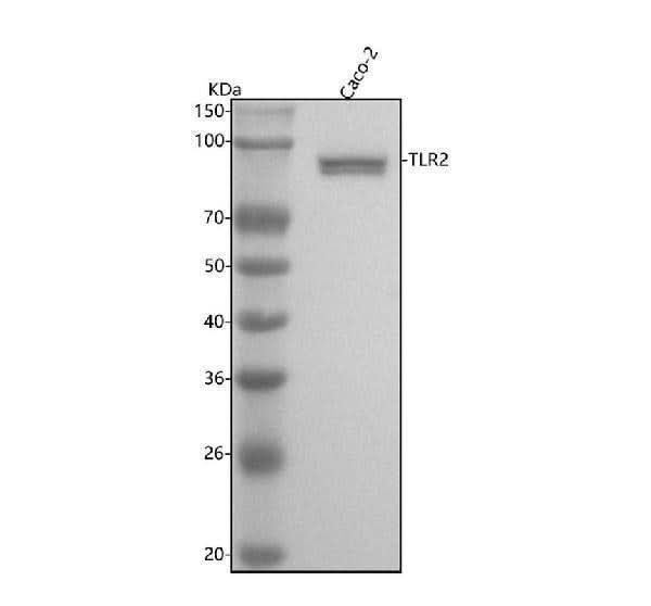Anti-TLR2 Rabbit Monoclonal Antibody Boster Bio