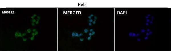 Anti-CTCF Rabbit Monoclonal Antibody Boster Bio