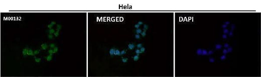 Anti-CTCF Rabbit Monoclonal Antibody Boster Bio