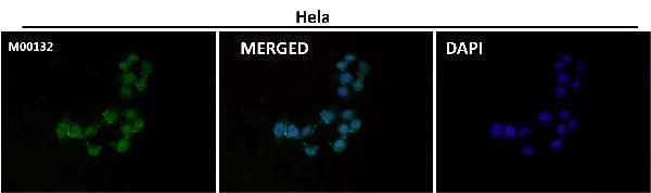 Anti-CTCF Rabbit Monoclonal Antibody Boster Bio