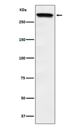 Anti-Huntingtin Monoclonal Antibody Boster Bio