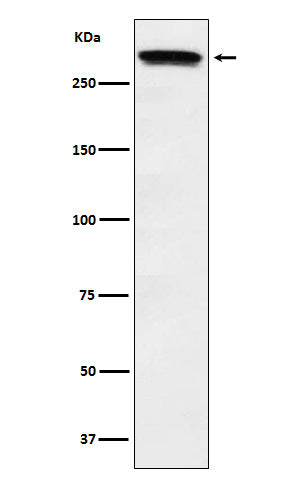 Anti-Huntingtin Monoclonal Antibody Boster Bio