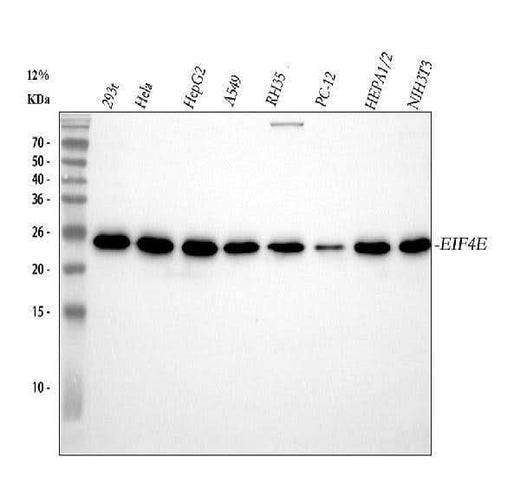 Anti-EIF4E Monoclonal Antibody Boster Bio