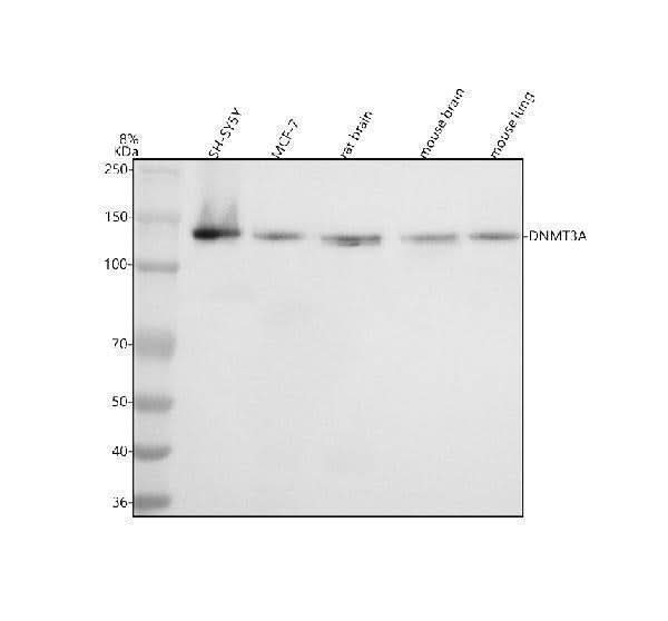 Anti-Dnmt3a Rabbit Monoclonal Antibody Boster Bio