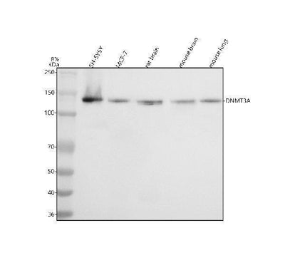 Anti-Dnmt3a Rabbit Monoclonal Antibody Boster Bio