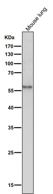 Anti-CD14 Rabbit Monoclonal Antibody Boster Bio