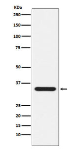 Anti-Presenilin 1 Monoclonal Antibody Boster Bio