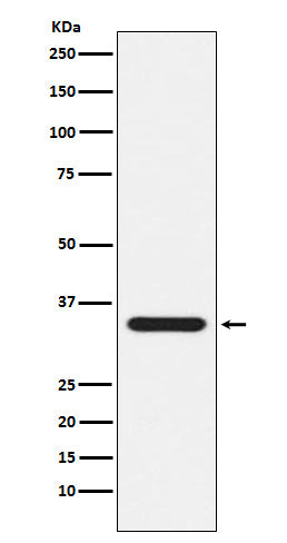 Anti-Presenilin 1 Monoclonal Antibody Boster Bio