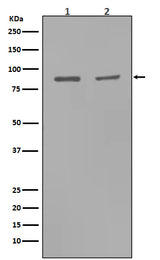 Anti-MMP9 Rabbit Monoclonal Antibody Boster Bio