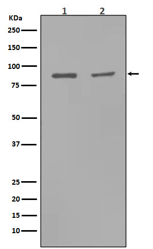 Anti-MMP9 Rabbit Monoclonal Antibody Boster Bio